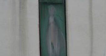 Virgin Mary's alleged appearance on a hospital window draws a hundred Catholics