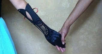 This Has to Be the Best-Looking 3D Printed Prosthetic Arm Ever