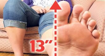 This Woman Has the Biggest Feet in Europe, and She Is Just 19