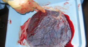 Human placenta