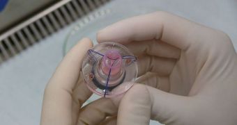 This is an artificially-engineered heart valve
