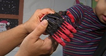 Toddler Gifted with New Hand by High Schoolers