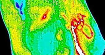 Thermal imaging of the body