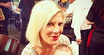 Tori Spelling has been hospitalized and received skin grafts after falling over hot hibachi grill on Easter Sunday
