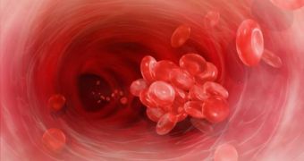 Blood clots are a serious condition to occur during travels, especially in people who are already predisposed to developing similar conditions