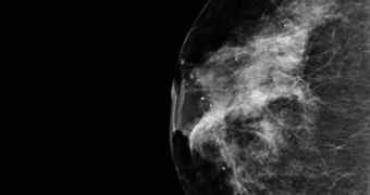 The full genetic code of triple negative breast cancer has been decoded