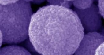 Scanning electron microscope image of the 300 nanometers popcorn-balls