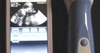 The new ultrasound imager is very small, and can connect to cell phones directly