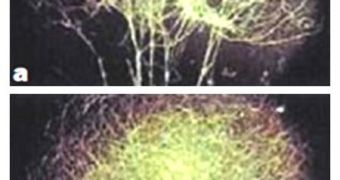 These images show the effect of estrogen on the growth of brain cells and circuitry: a) mouse brain tissue without estrogen, and b) with the addition of estrogen