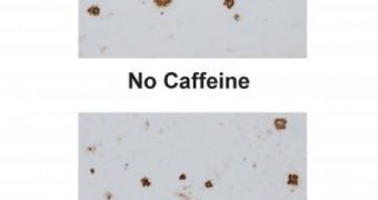 Caffeine treatment removed the beta amyloid plaques from the brains of the Alzheimer's mice