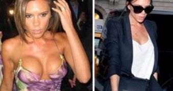 Victoria Beckham admits that she had breast implants but later had them removed