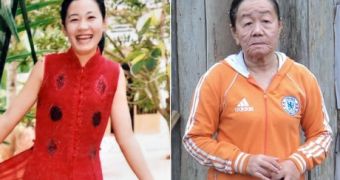 Vietnamese woman says she went from young to old in only a few days