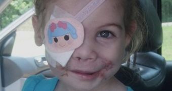 KFC says 3-year-old disfigured girl was never kicked out of one of its restaurants