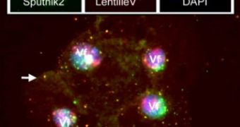 Lentille, the new giant virus, and Sputnik 2 the virophage