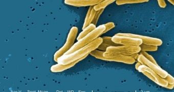 Vitamin D Speeds Up Recovery from TB