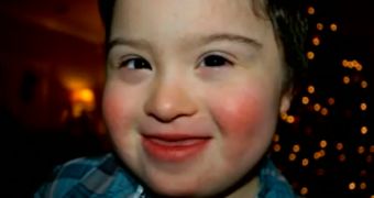 Kim Castillo's son, Milo, suffers from Down's syndrome
