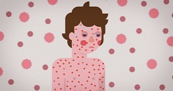 Science video explains how measles behaves once inside the body