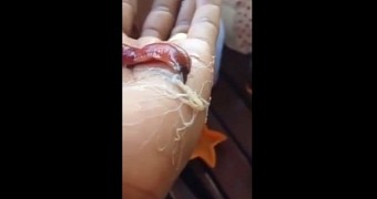 Watch: Worm Puking Freaky Appendage Will Scar You for Life