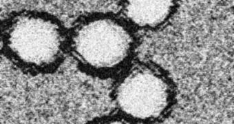 This is a TEM image of the West Nile virus