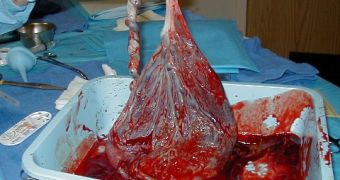 A human placenta