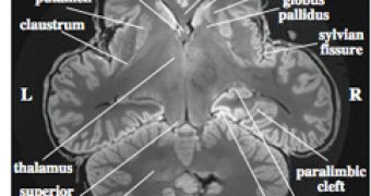 CT scan of an elephant brain