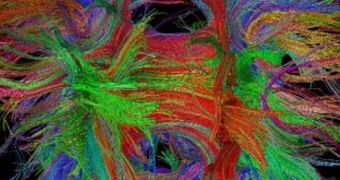 Diffusion tensor imaging photo of the human brain