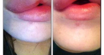 Monroe piercing doesn’t come without risks, here’s what an infection might do to your face