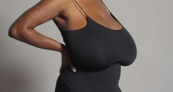 Woman with Natural 36NNN Breasts Undergoes Reduction, Gets New Lease on Life – Video