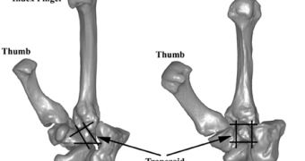 A comparison of wrist bones like those found in the "hobbit" human (left) and those of a modern human