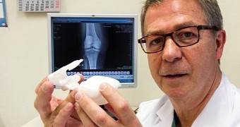 X-Rays Become Guides for Knee Replacement Surgeries Thanks to 3D Printing