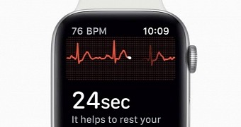 ECG app on Apple Watch