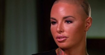 Christy Mack had facial reconstructive surgery after War Machine attack, in August 2014