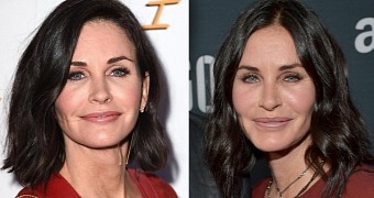 Courteney Cox has been getting a lot of work done on her face, and she wants more for her wedding to Johnny McDaid