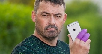 The iPhone caused injuries to two fingers