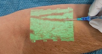 Here's a Useful Medical Device That Shows a Patient's Veins