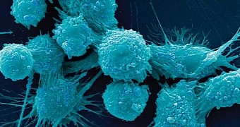 Researchers Watch Cancer Tumors Grow in Real Time