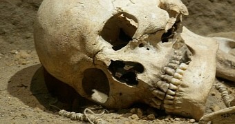 Big holes in the skull are a sign of intelligence, study reveals