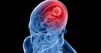 New study offers hope to glioblastoma patients