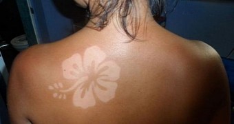 An example of "sunburn art," where a flower "tattoo" has been created by covering a piece of skin and preventing tanning