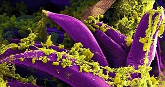 Image shows Yersinia pestis colonizing a flea's digestive system