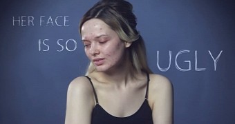 Woman Exposes Online Bullying in Heartbreaking Video: You Look Disgusting