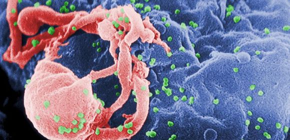 AIDS Immunity Has Genetic Secret