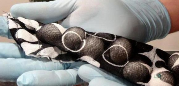 Czech Man Hides Wild Bird Eggs in His Pants and Tries to Smuggle Them into Australia