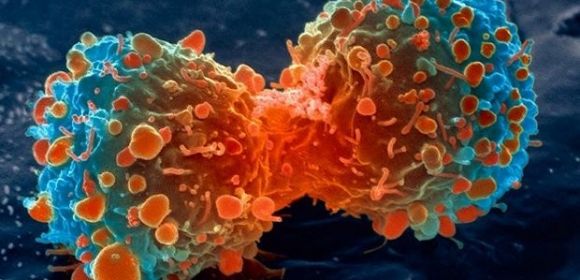 Drug Cocktail Obliterates Cancer Tumor Growing Inside Woman's Chest