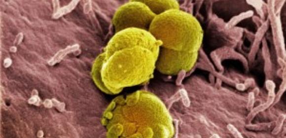 Drug-Resistant Gonorrhea Arrives in North America