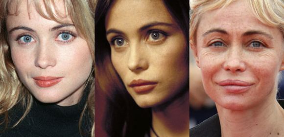 French Beauty Emmanuelle Beart Warns of the Dangers of Plastic Surgery