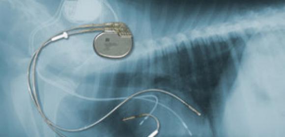 Medical Warning: MP3s Are Dangerous for Pacemakers!