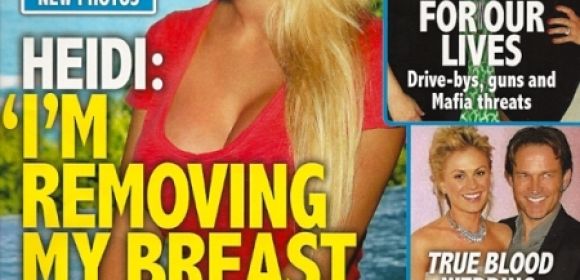 Plastic Surgery Ruined My Marriage and My Life, Says Heidi Montag