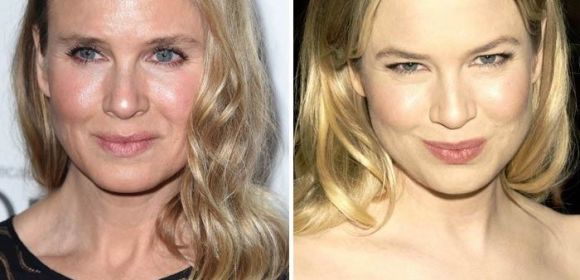 Renee Zellweger Looks Nothing like Herself Anymore and She Knows It – Photo