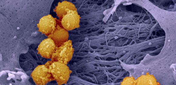 Scientists 'Infected' Staph Bacteria